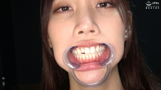 [Teeth/Mouth] Precious observation of the oral cavity, throat, and tongue tongue of a popular actress who made her debut as a solo actress ★ Lara Shinosaki