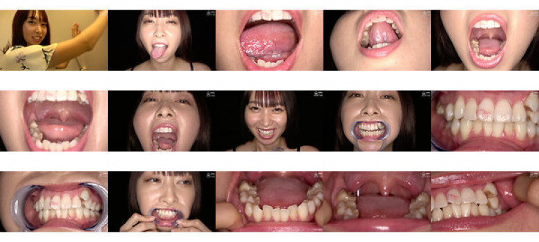 Observation of Mouth, Teeth and Throat Mirai Domoto:SampleImage