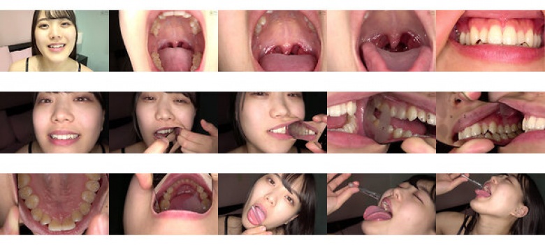 Extremely rare mouth, uvula, teeth, saliva observation Mina Mizuto:SampleImage