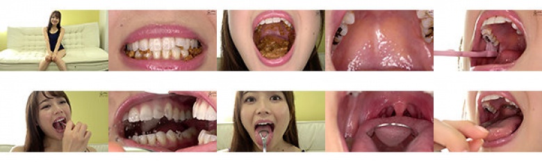 Mouth Fetish-Super Rare Teeth / Mouth-Chiharu Miyazawa:SampleImage