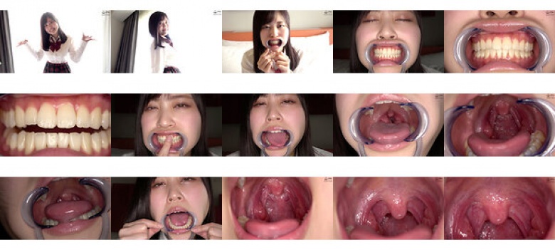 Observation of uvula, teeth and uvula Ayaka Mochizuki:SampleImage