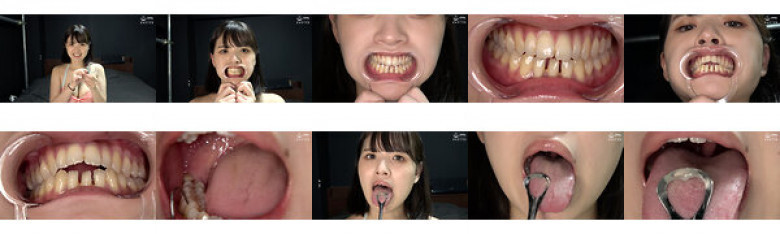 "[Teeth/Oral] Observation of popular model Amu Otoba's super rare teeth, mouth, and tongue tongue!" Amu Otoba:SampleImage