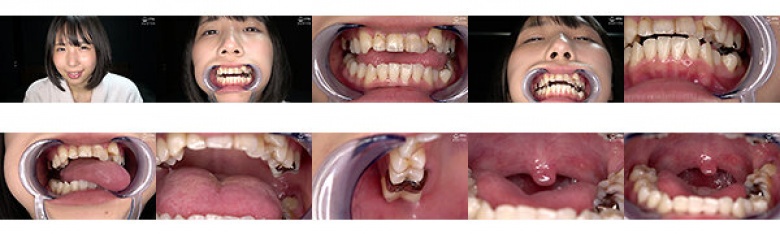 [Teeth/Mouth] Observe the extremely rare teeth, silver teeth, inside of the mouth, and throat of a popular actress! Monaka Sengoku:SampleImage