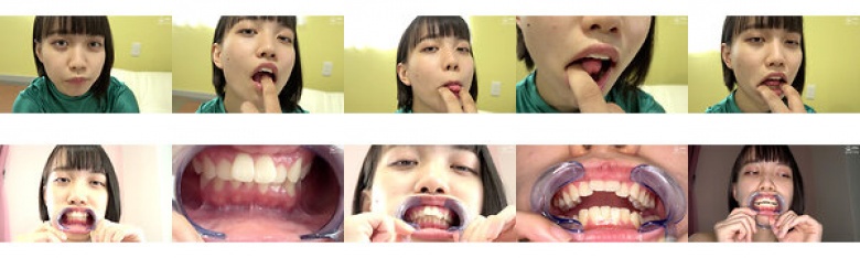 Finger Blow and Teeth / Oral Observation Yukino Eru:SampleImage