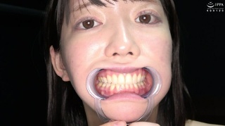 [Teeth/Mouth] Idol&apos;s extremely rare tongue, throat, and teeth observation play Mion Usami